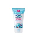Acne Clear Antibacterial Face Wash Gel Dermacol